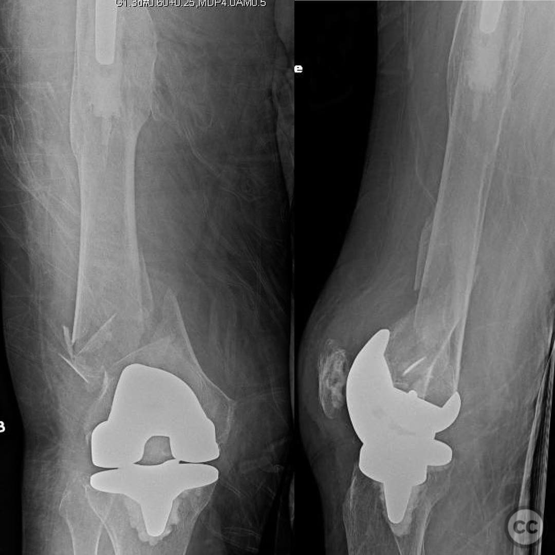 case image
