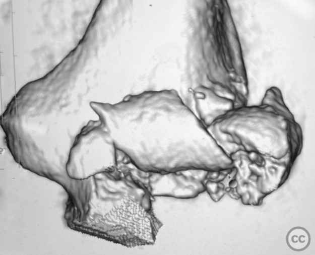 case image