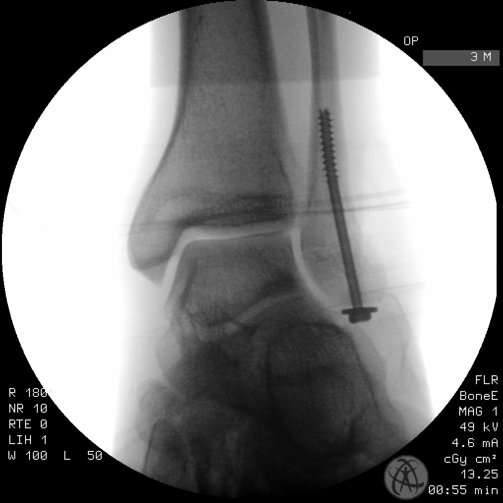 case image