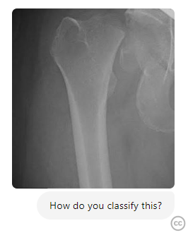 case image