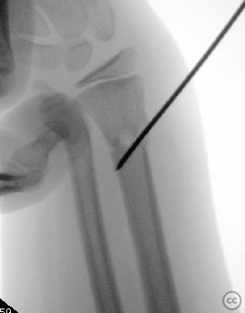 case image