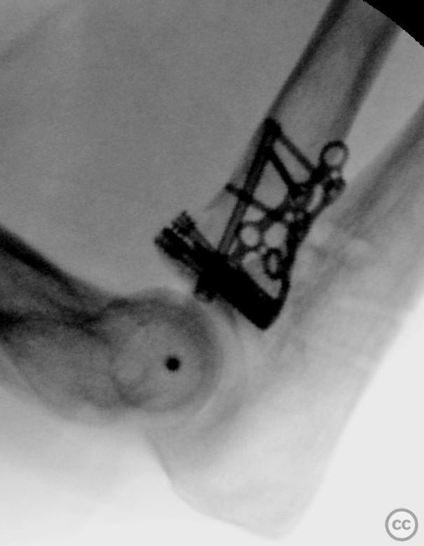 case image