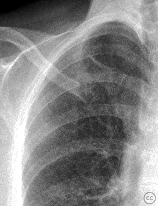 case image