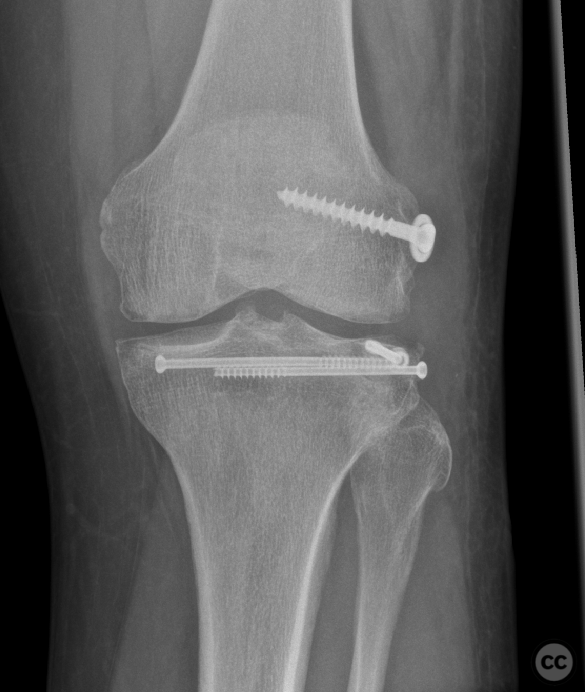 case image