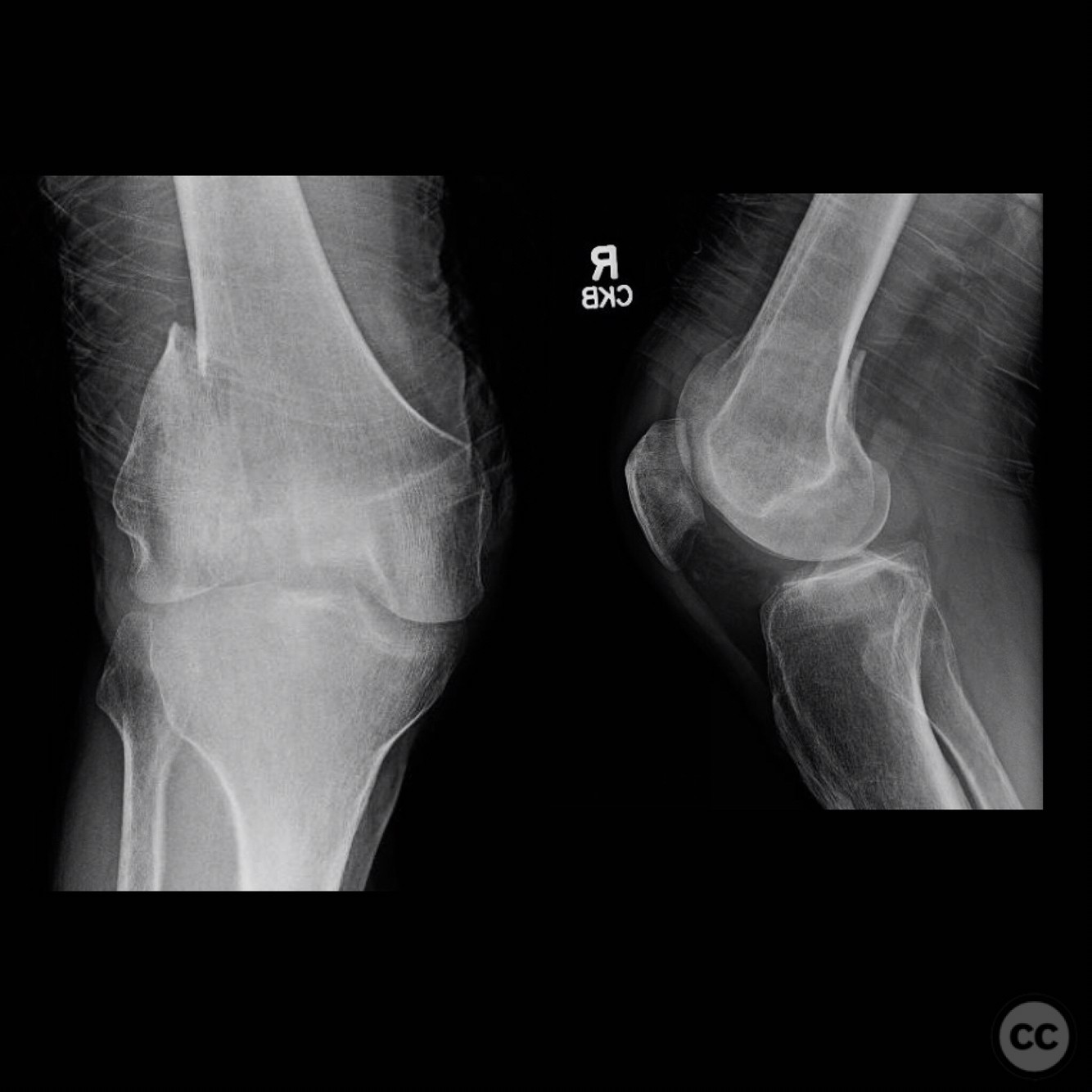 case image