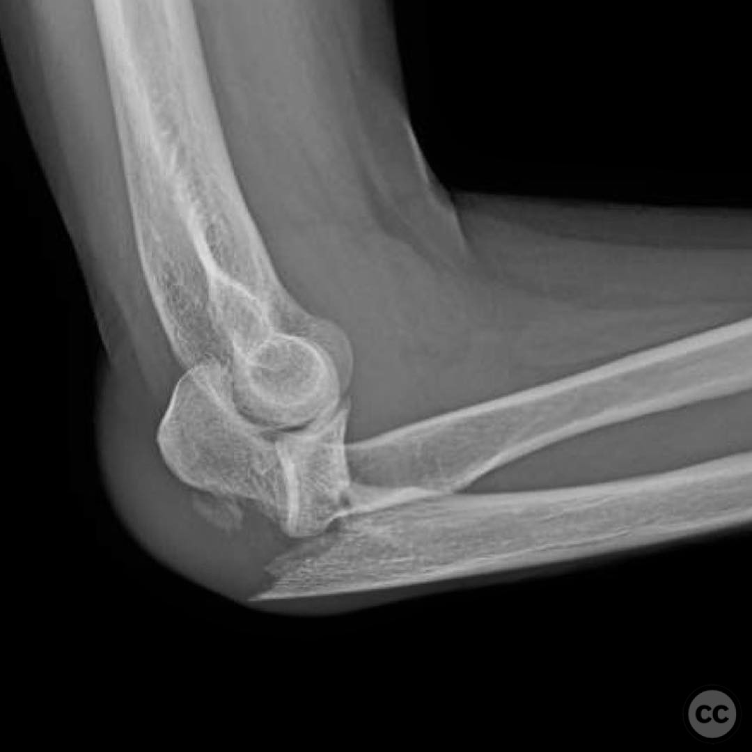 case image