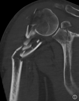 case image