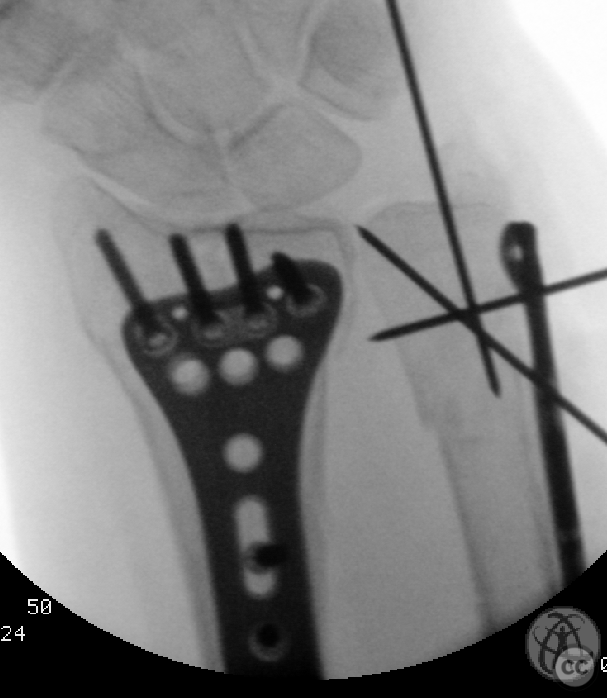 case image