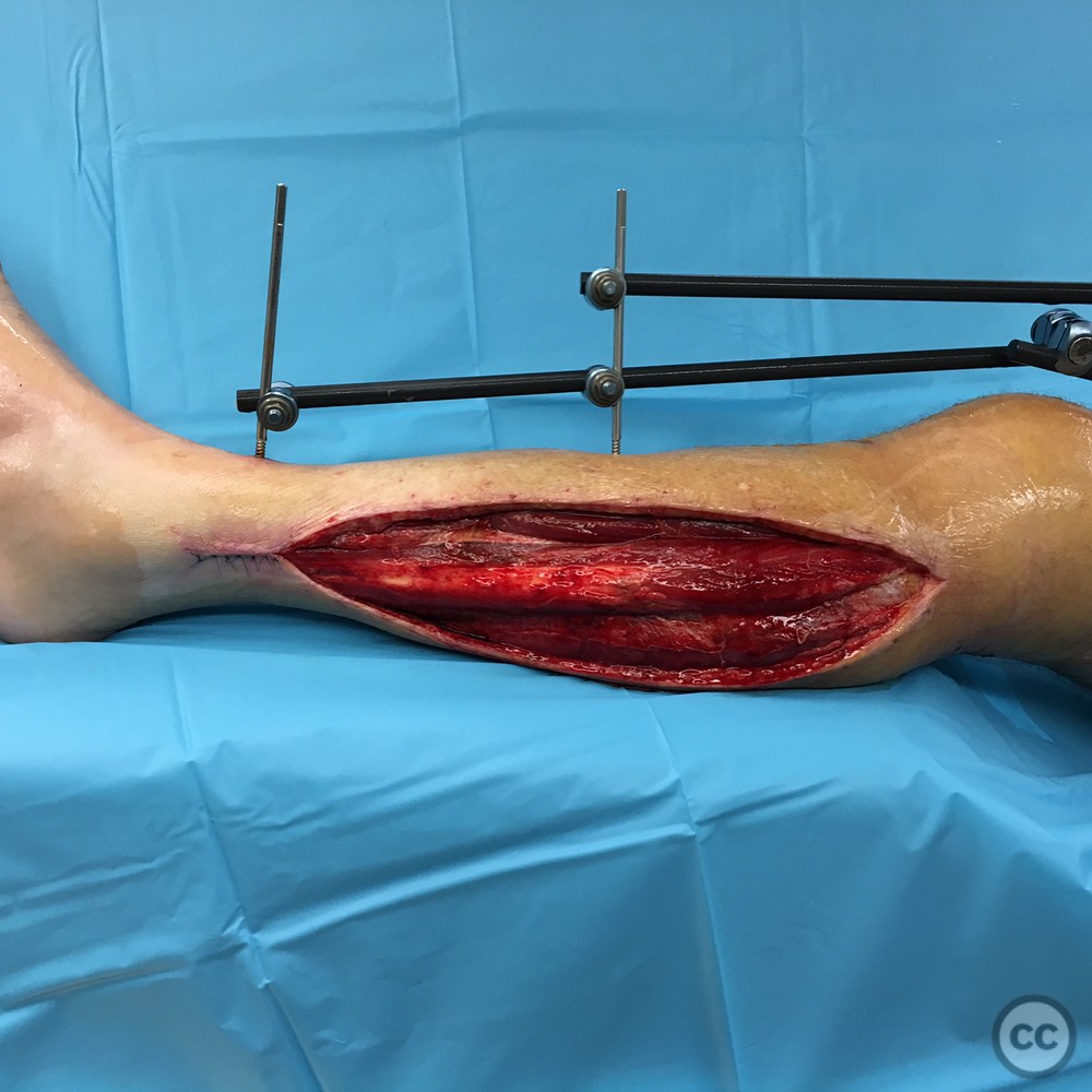 case image