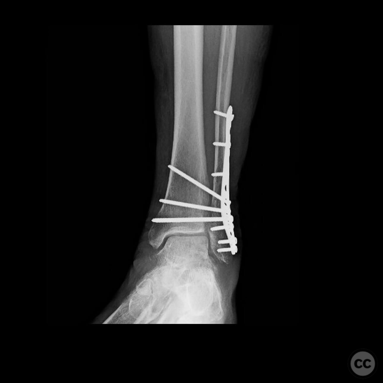 case image