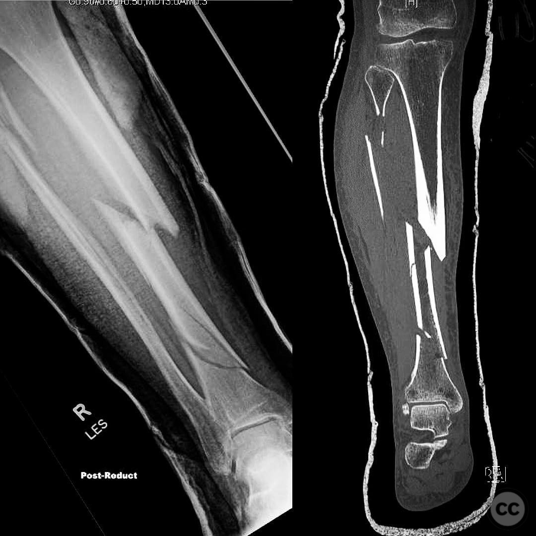case image