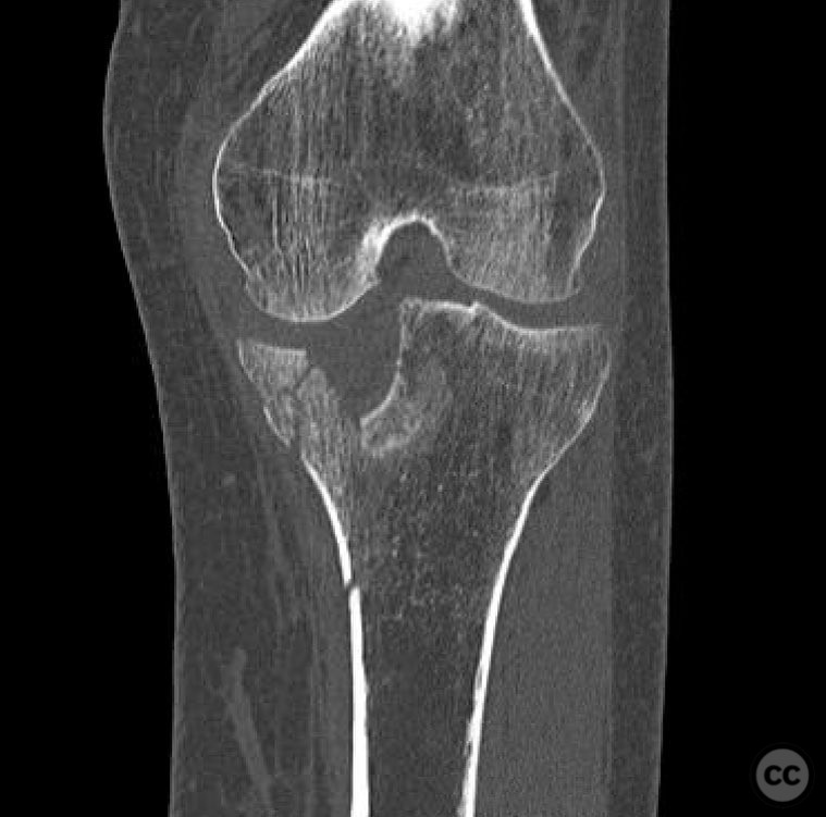 case image