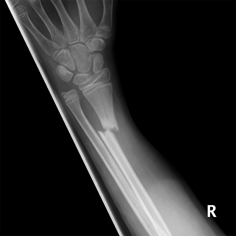 case image