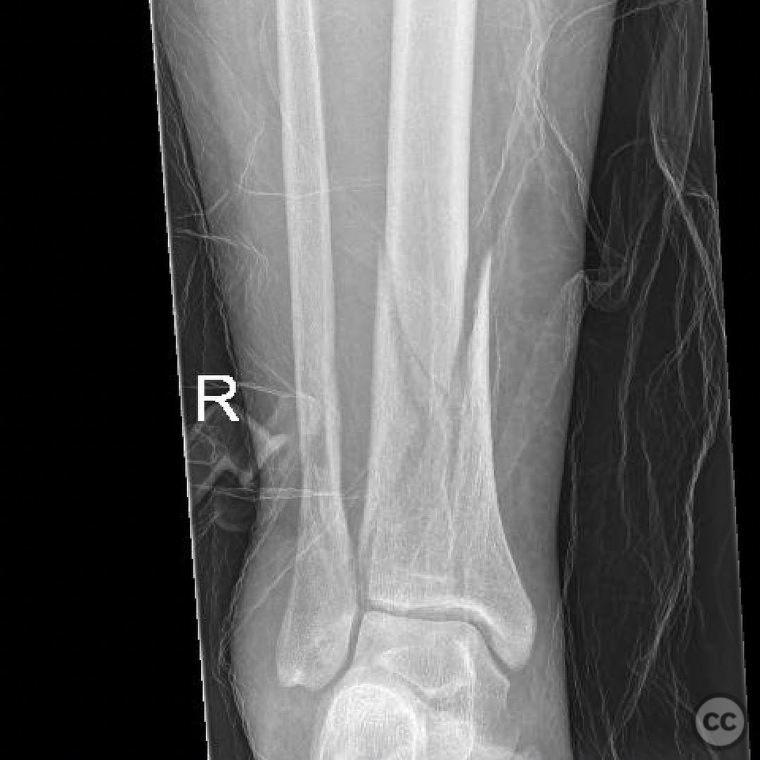 case image