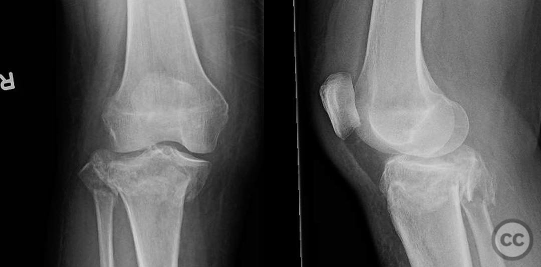 case image