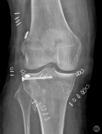 case image