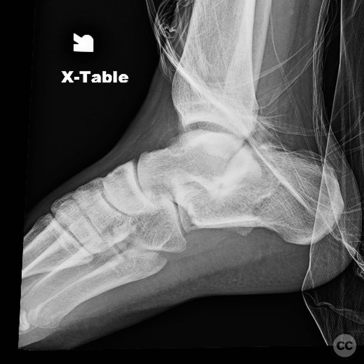 case image
