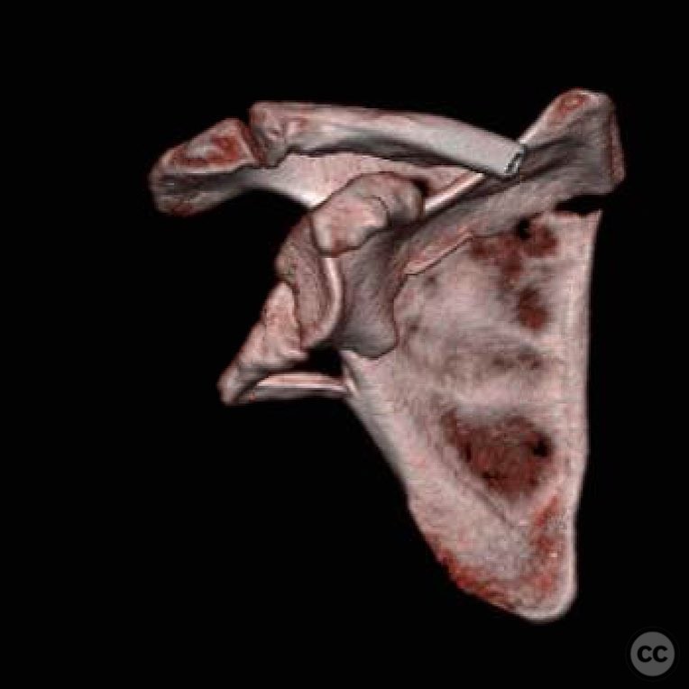 case image
