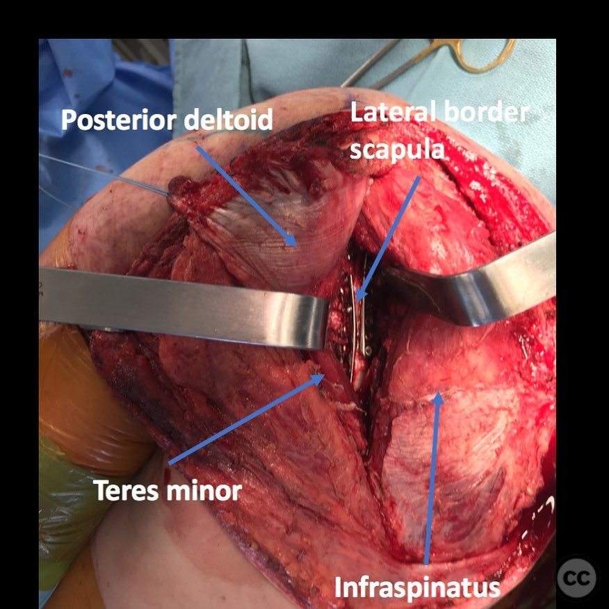 case image