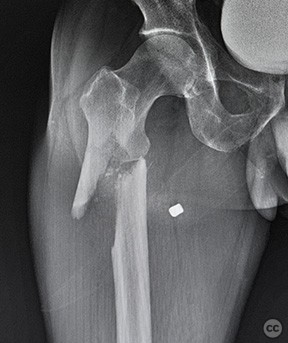 case image