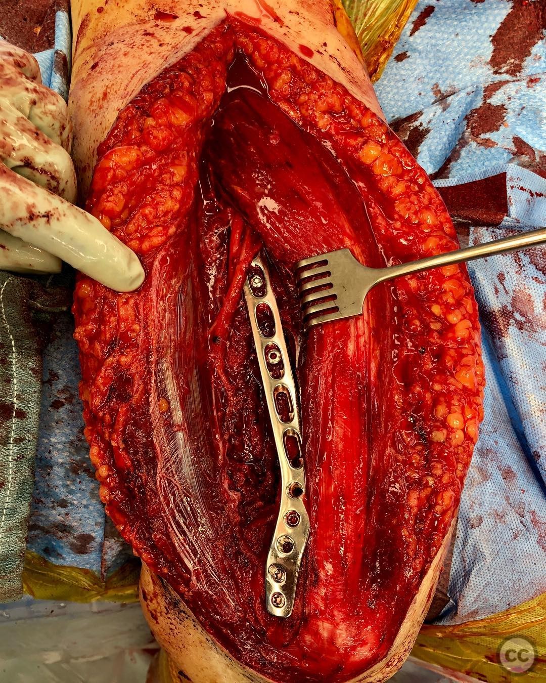 case image