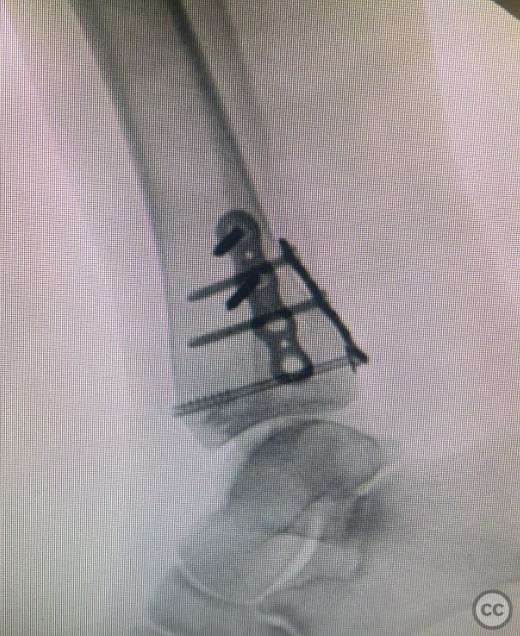 case image