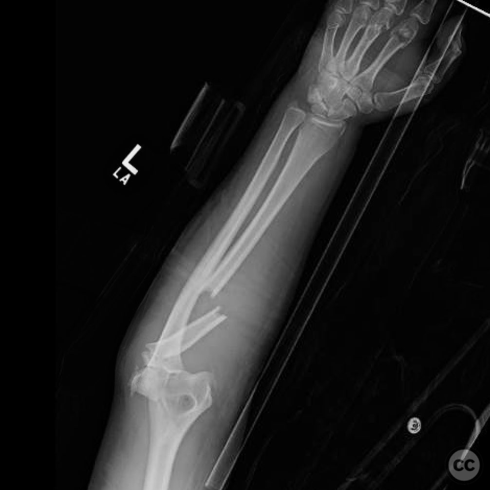 case image