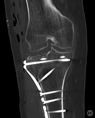 case image