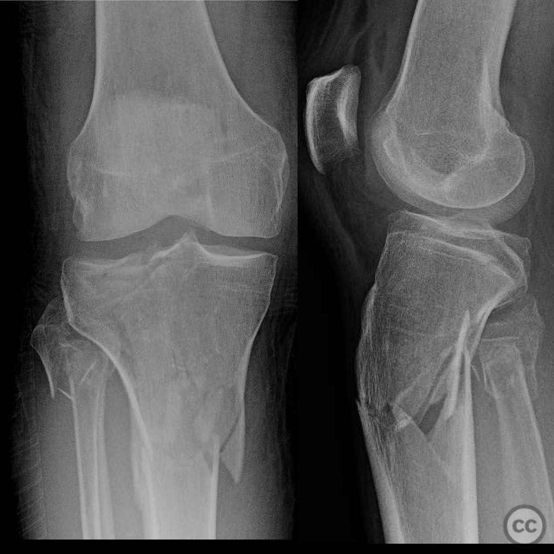 case image