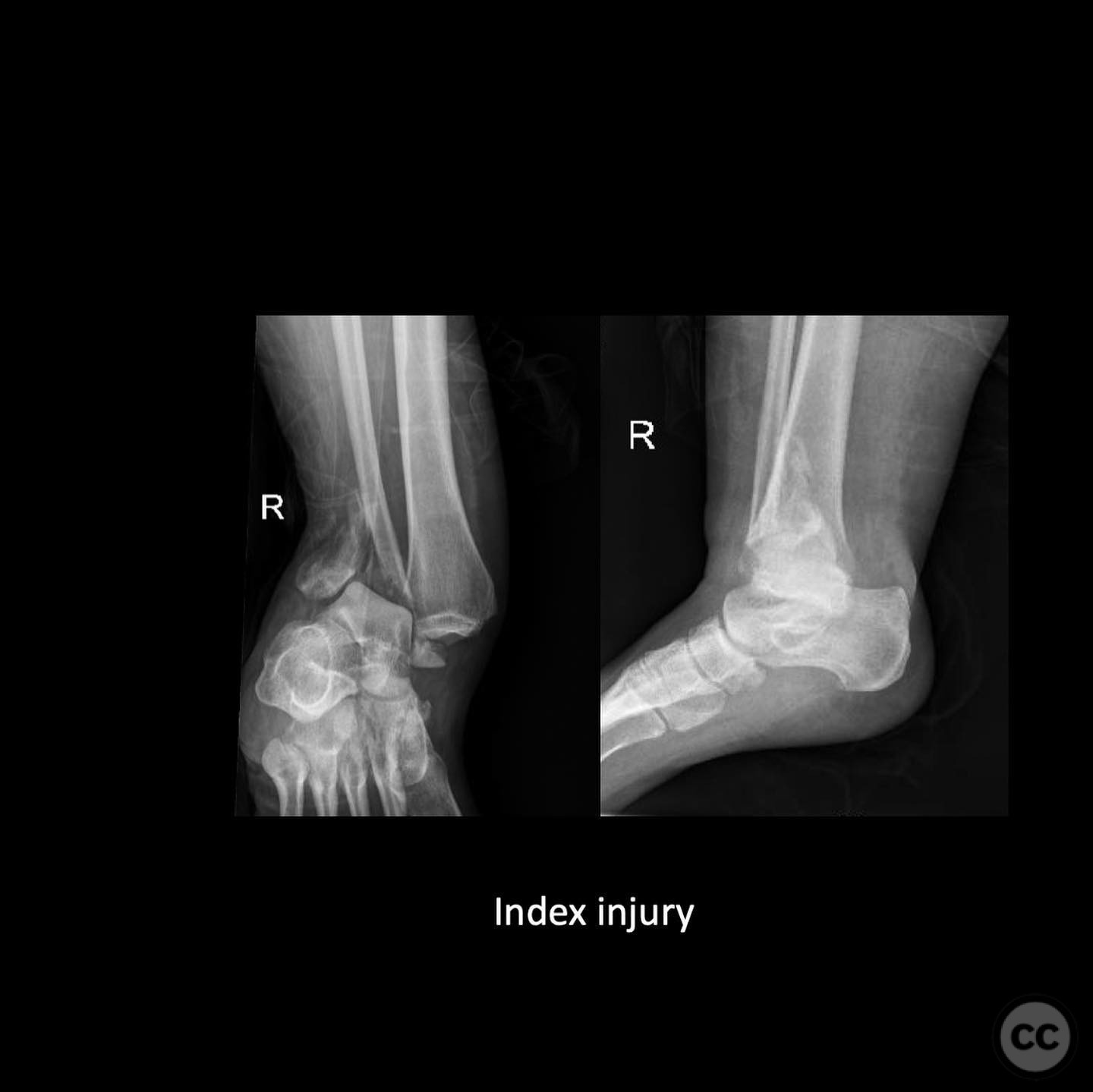 case image