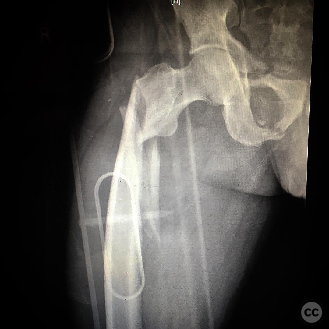 case image