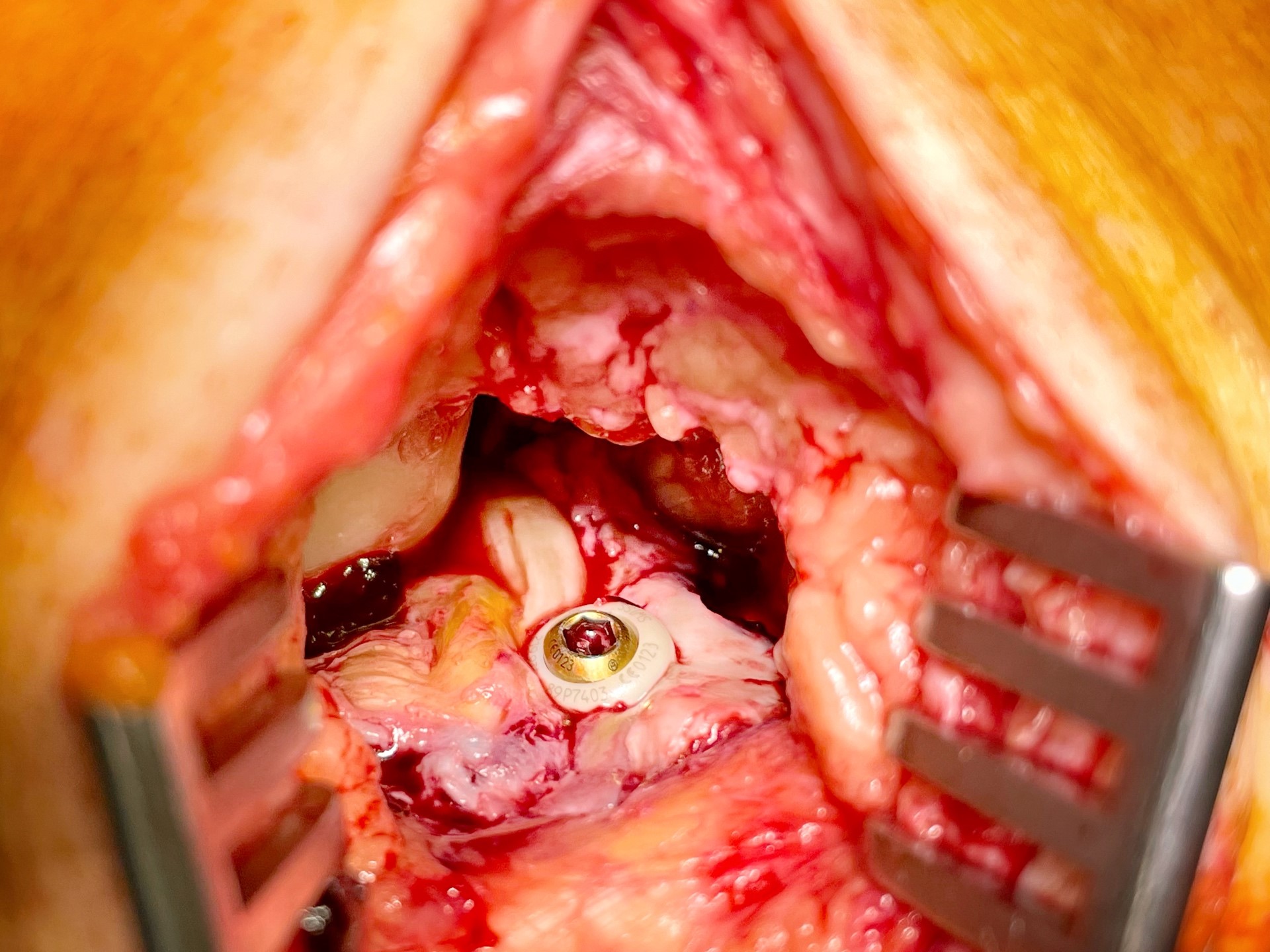 case image