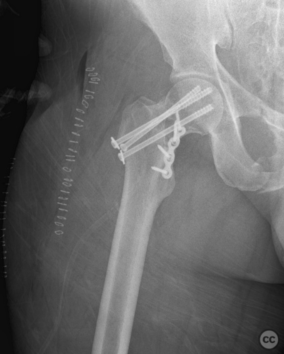 case image