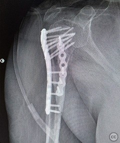 case image