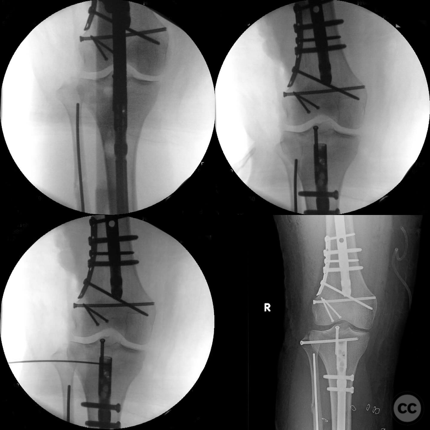 case image