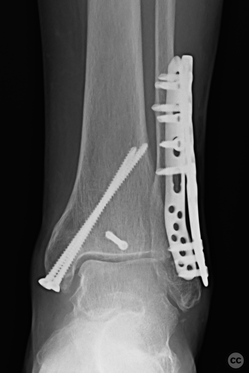 case image