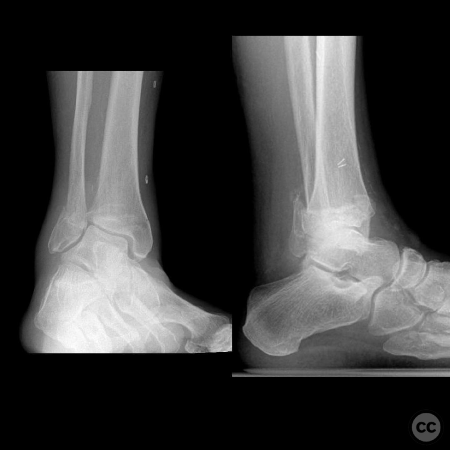 case image