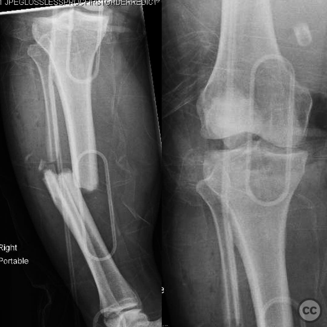 case image