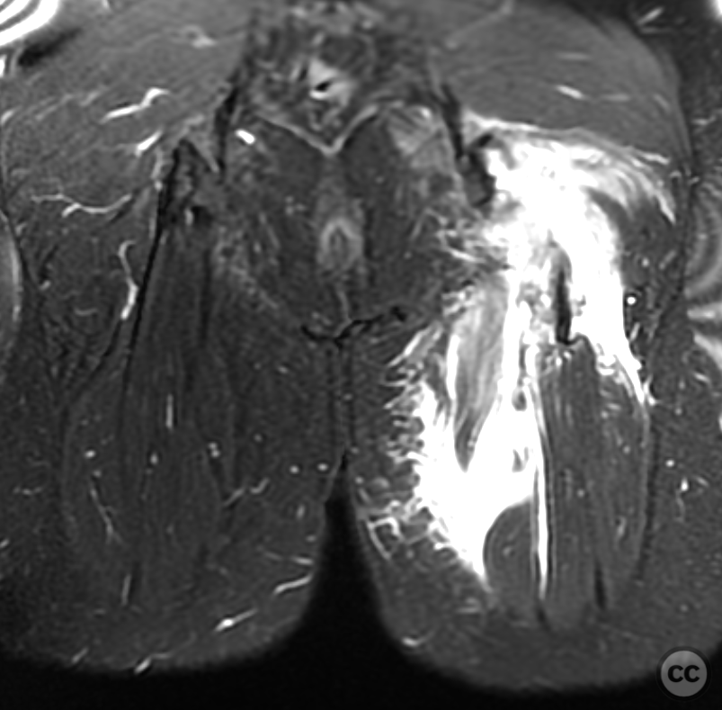 case image