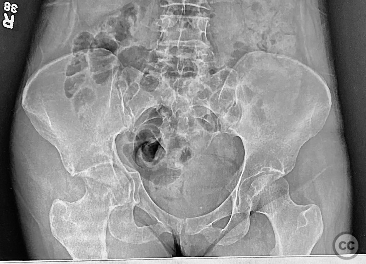 case image