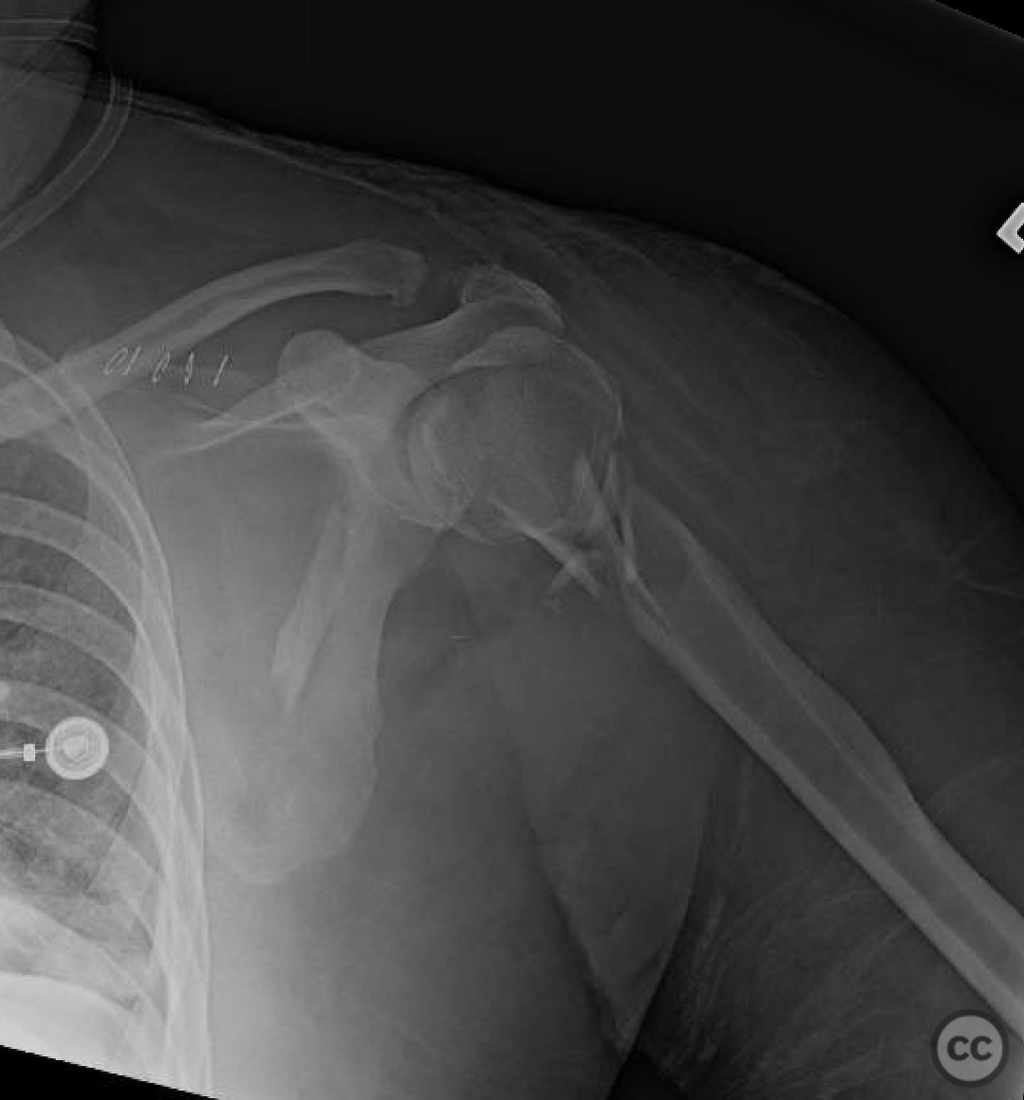 case image