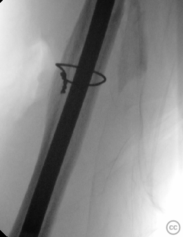 case image