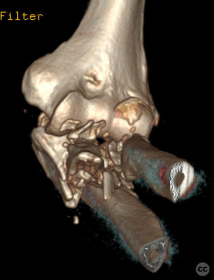 case image