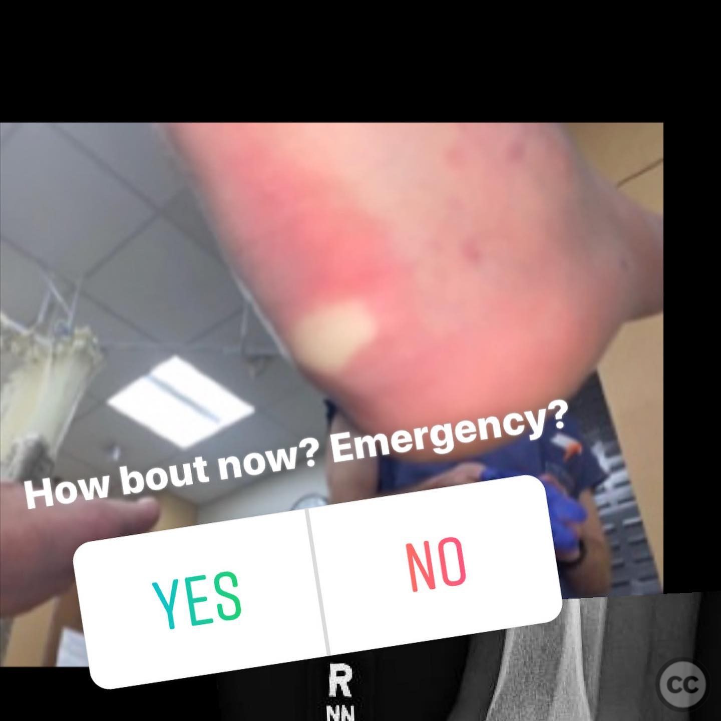 case image