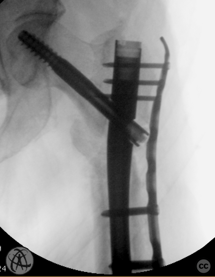 case image