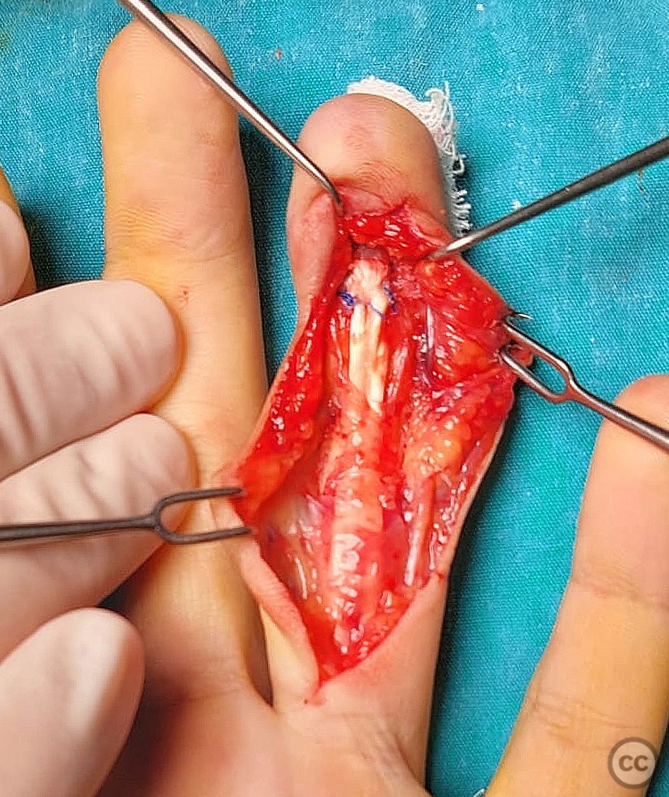 case image