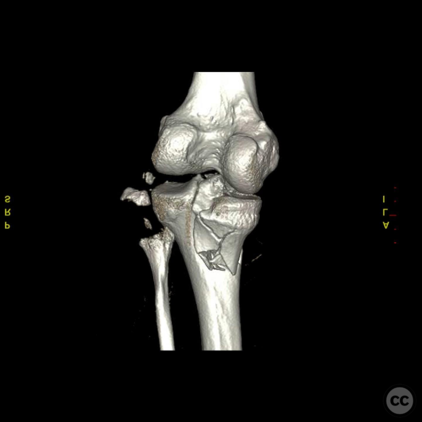 case image