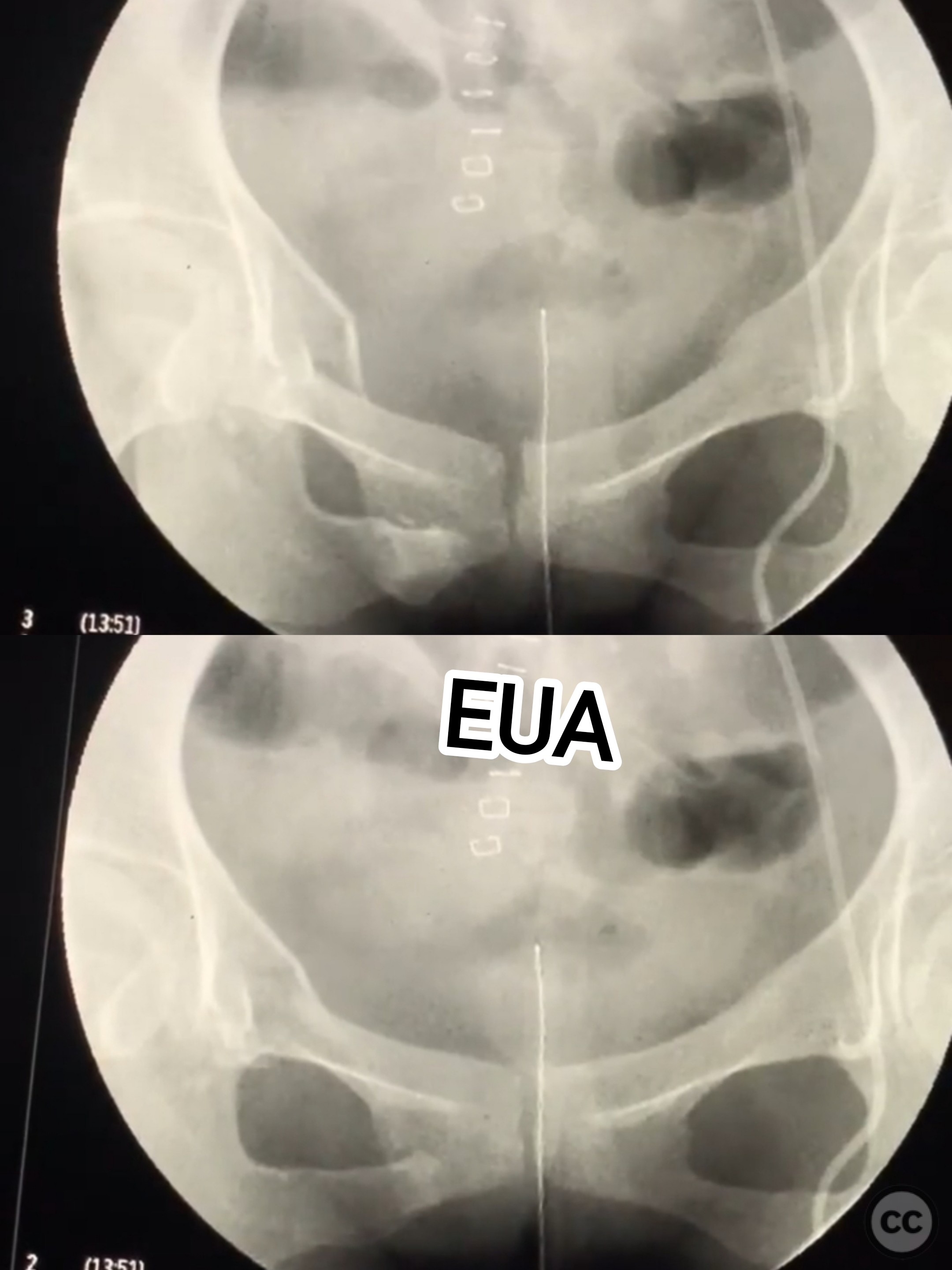 case image