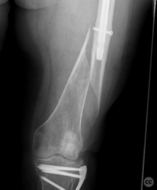 case image