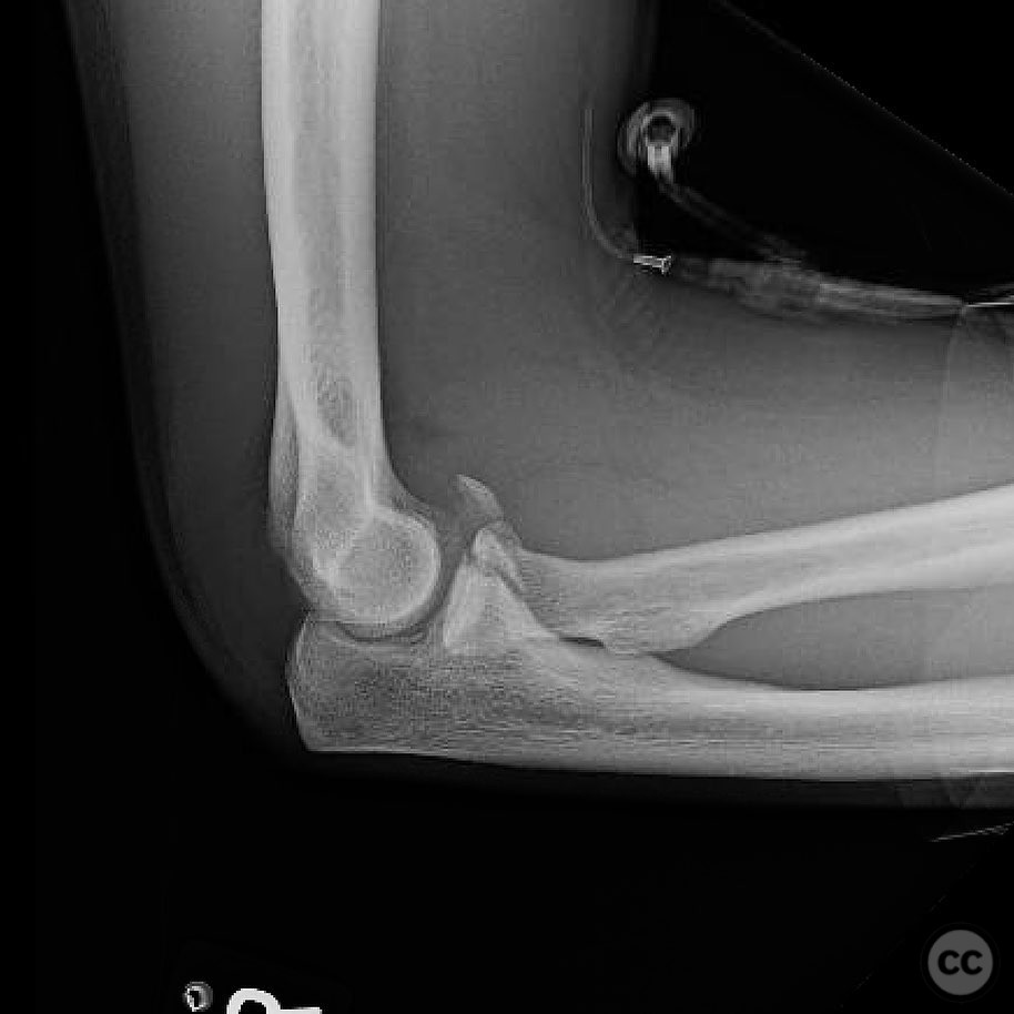case image